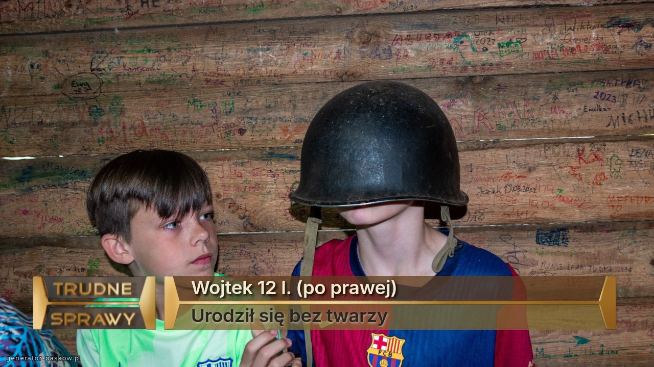 Wojtek 12 l. (po prawej)
Urodził się bez twarzy
