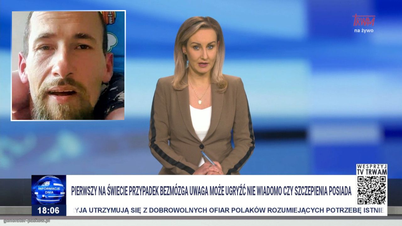 Pierwszy na świecie przypadek bezmózga uwaga może ugryźć nie wiadomo czy szczepienia posiada