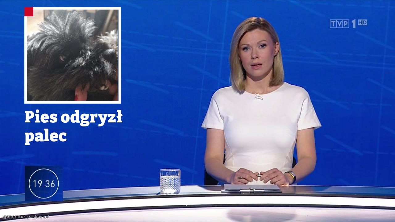 Pies odgryzł palec