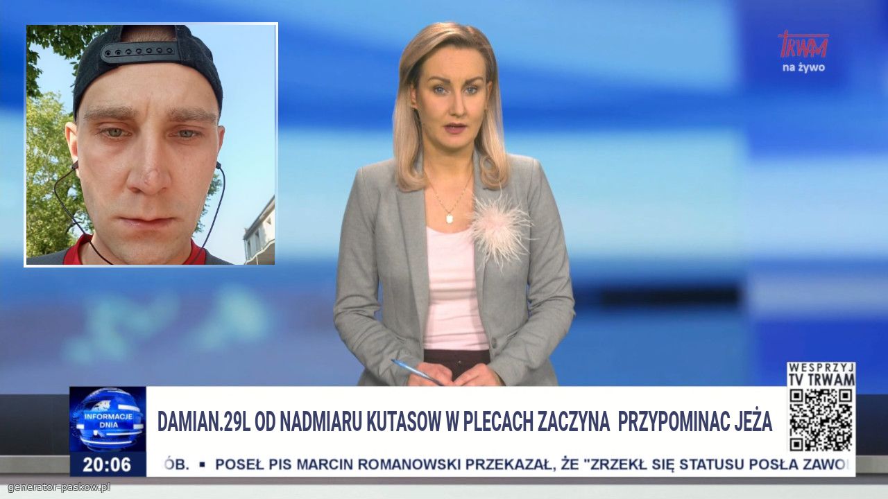 DAMIAN.29l od nadmiaru KUTasow w plecach zaczyna  przypominac jeża 