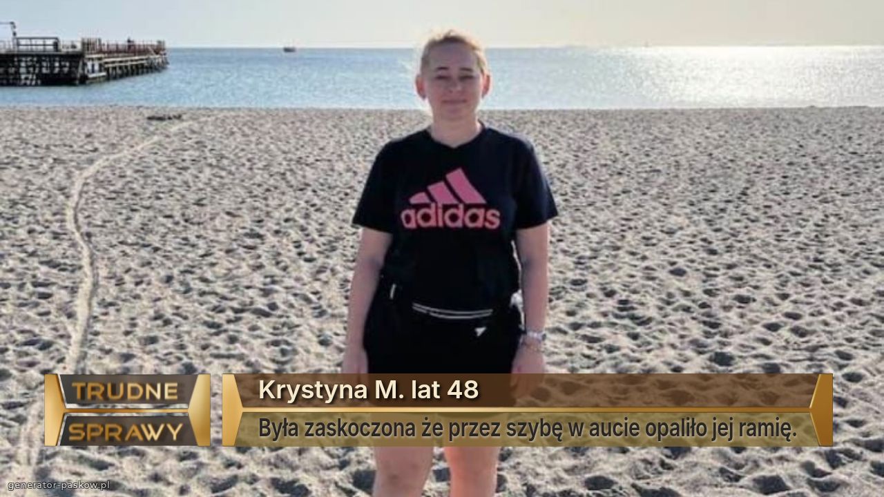Krystyna M. lat 48
Była zaskoczona że przez szybę w aucie opaliło jej ramię.
