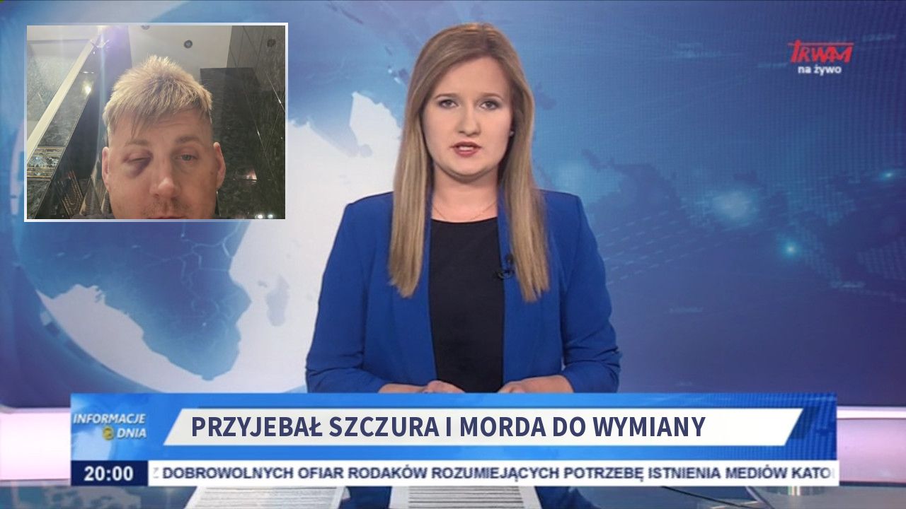 Przyjebał szczura i morda do wymiany